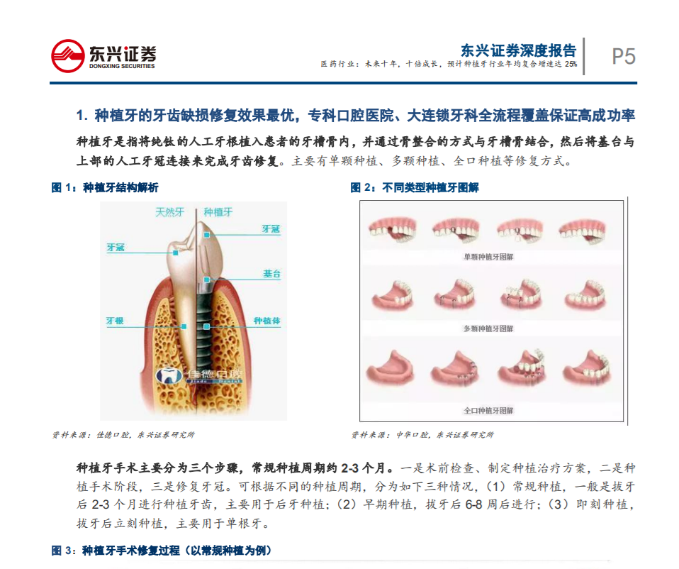未來(lái)十年，十倍成長(zhǎng)，預(yù) 計(jì)種植牙行業(yè)年均復(fù)合增速達(dá)25%——東興證券
